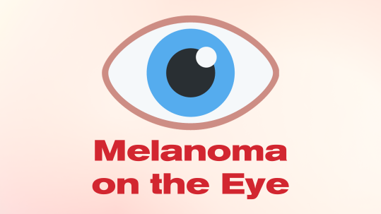 melanoma on the eye