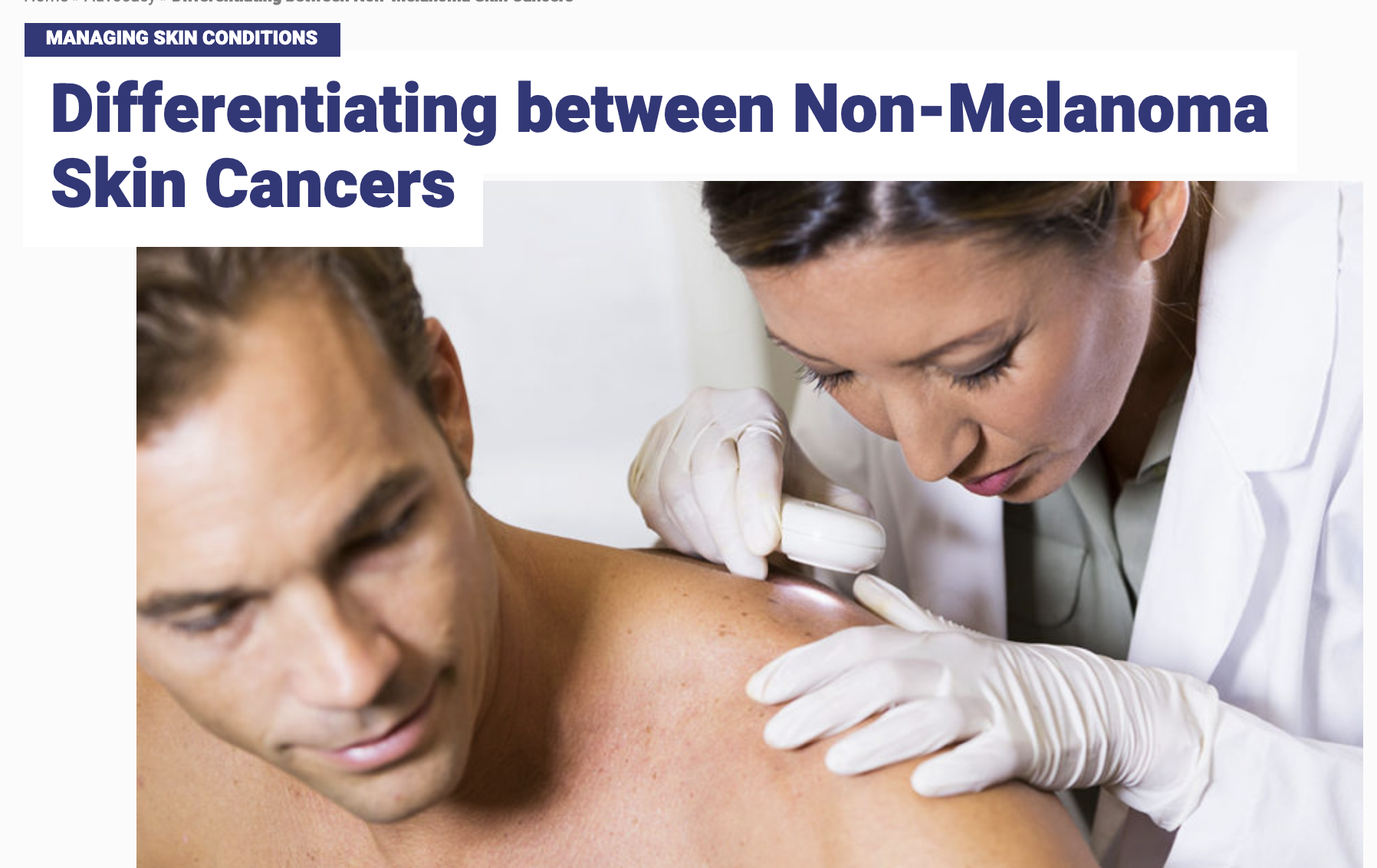 non-melanoma skin cancers